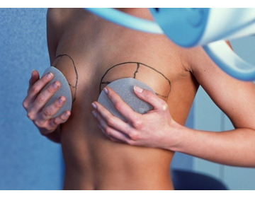 Увеличение груди – все об операции