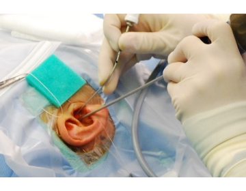 Преимущества и показания к трансканальной эндоскопической хирургии уха