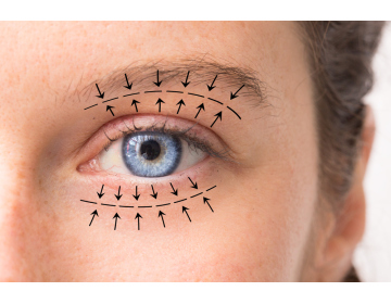 Кому реально показана блефаропластика й кому краще інша тактика