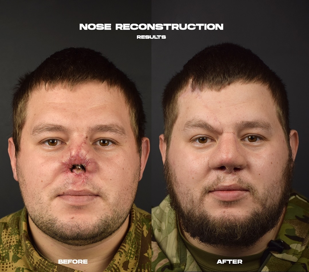 plasticheskij-hirurg-slosser