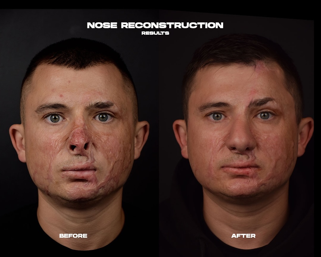 plasticheskaja-hirurgija-slosser-dmitrij