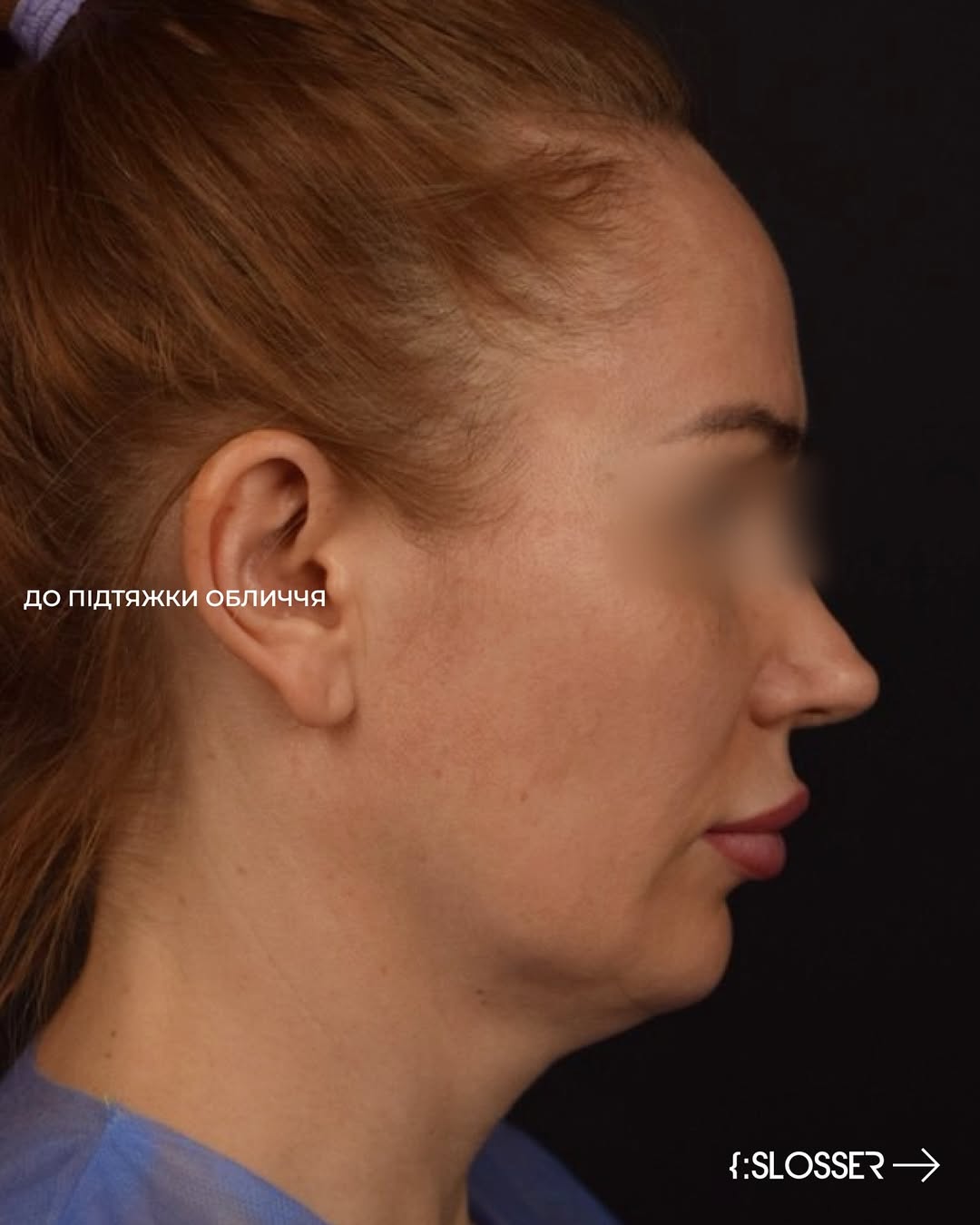 slosser-dmitrij-slosser-dmytro