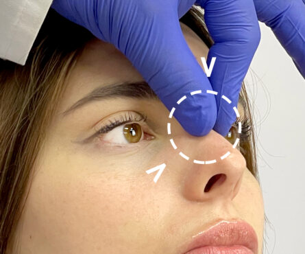 Revision Plastic Surgery: What to Do If You Are Unhappy with the Results of a Previous Procedure